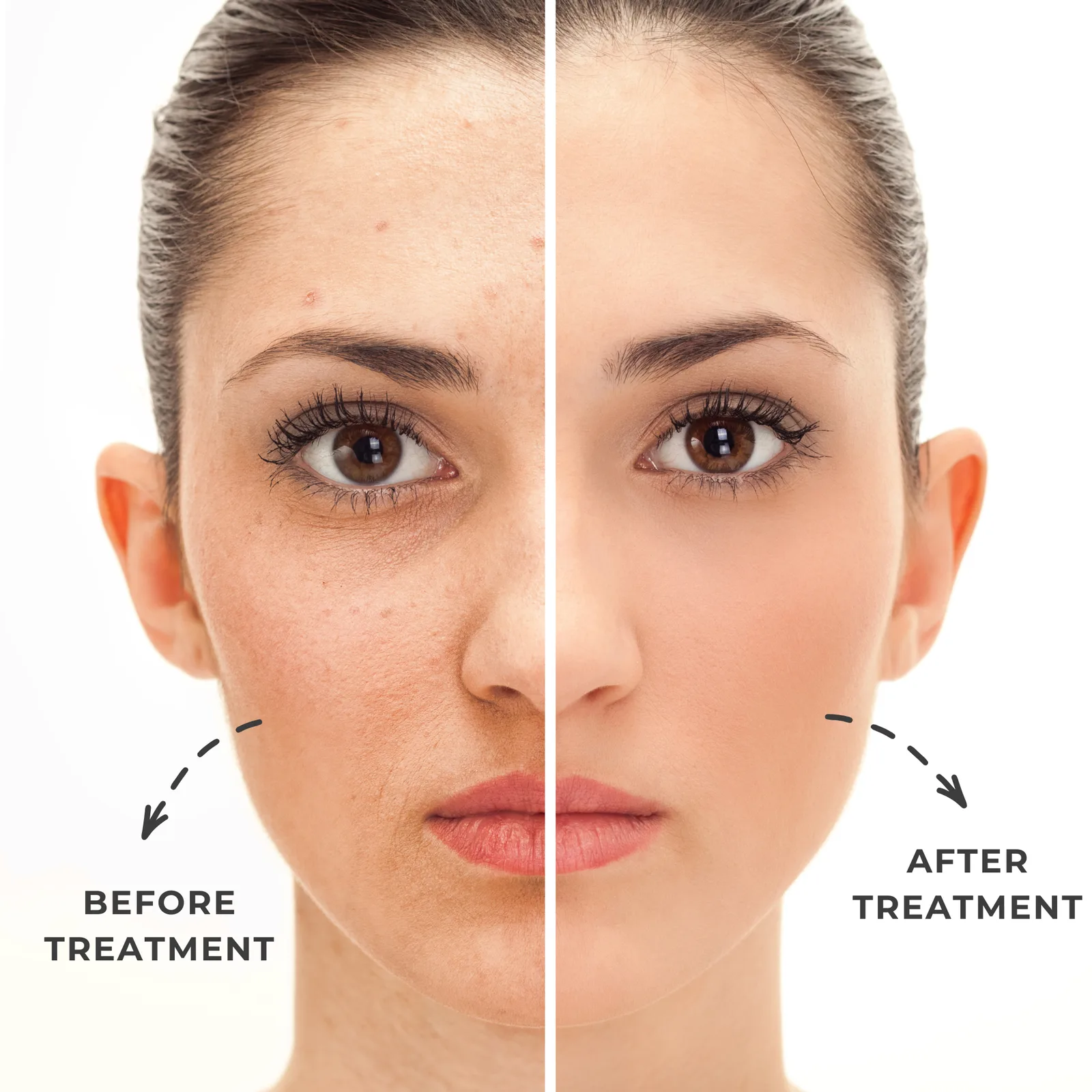 MELAGLOW Skin Lightening Serum — view 3